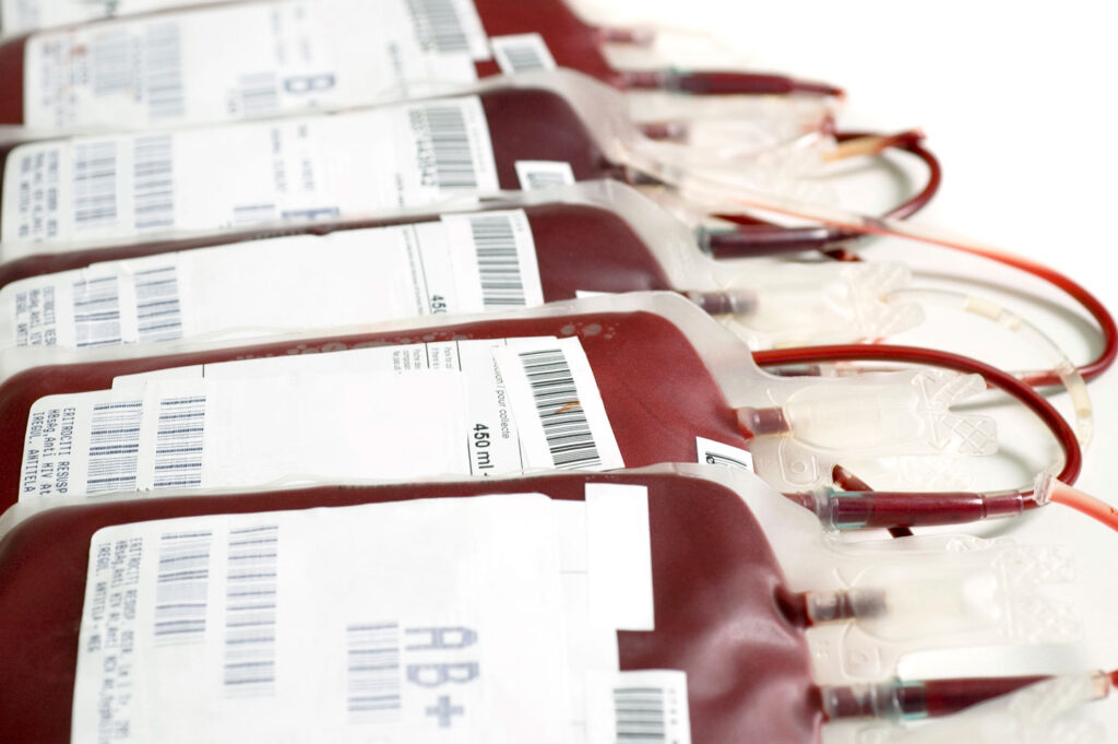 blood transfusion improvements